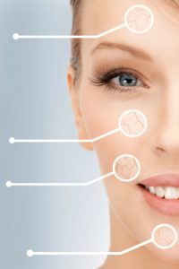 Diagram showing blemishes in a woman's face