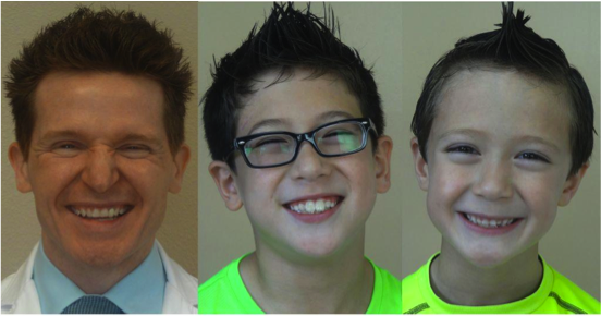 Duchenne Smile duchenne smile