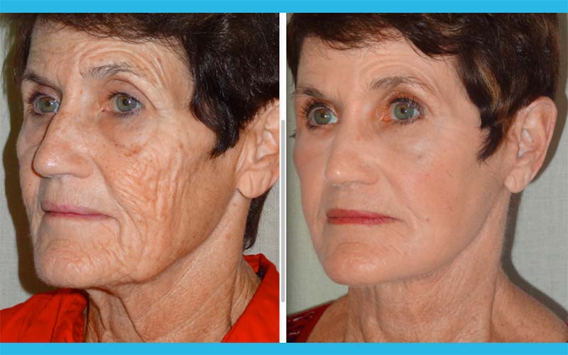 Dr. Castellano Patient 04
