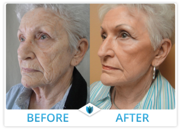 Cosmetic Surgery 01