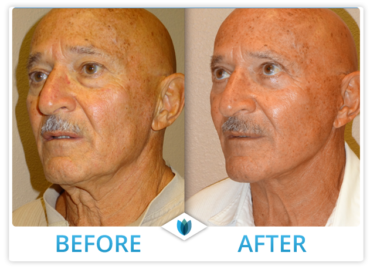 Cosmetic Surgery 03