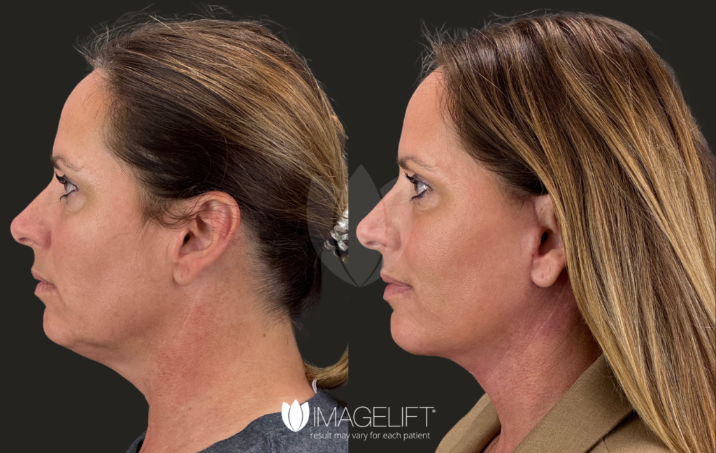 Lisa DeBusman - Dr. McEwan - IL wLL